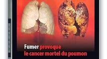 Bientôt des photos choc sur les paquets de cigarettes ?