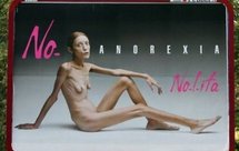 Mort d'Isabelle Caro, jeune mannequin anorexique Mort d'Isabelle Caro, jeune mannequin anorexique
