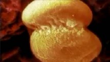 Le blastocyste commence à s'applatir et à s'allonger. Le blastocyste commence à s'applatir et à s'allonger.