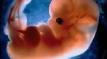 Le foetus n'a plus qu'à grandir.