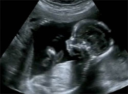 Enceinte Tout Savoir Sur Les Neuf Mois De Grossesse Enceinte Tout Savoir Sur Les Neuf Mois De Grossesse