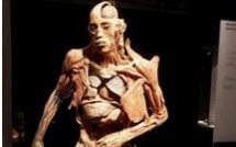L'exposition 'Our body' interdite par la justice