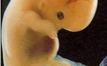 Bioéthique : la loi maintient l'anonymat du don de gamètes